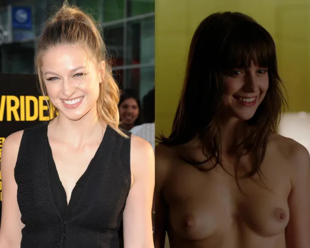 Thumbnail Melissa Benoist: The Shining Star of OnOffCelebs