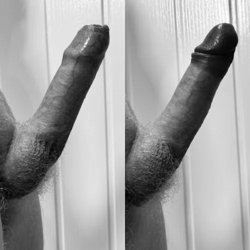 Thumbnail Which Would You Prefer: Foreskin Dilemma by Confident-Ad11011