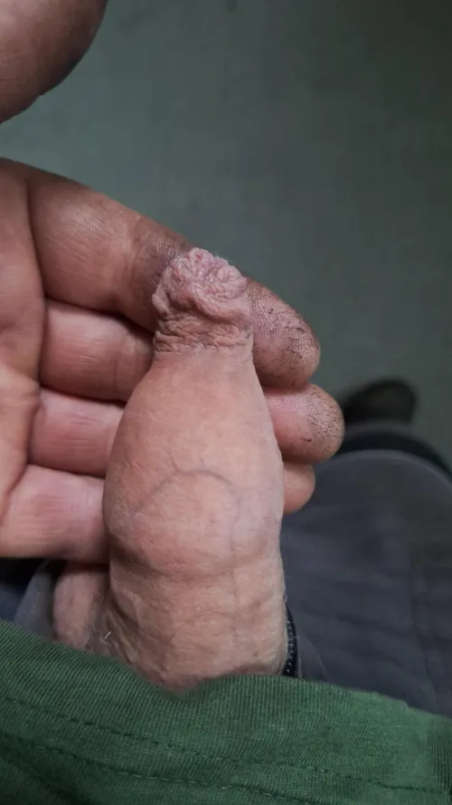 Thumbnail Exploring Foreskin by MrBcurioushere | Foreskin Category