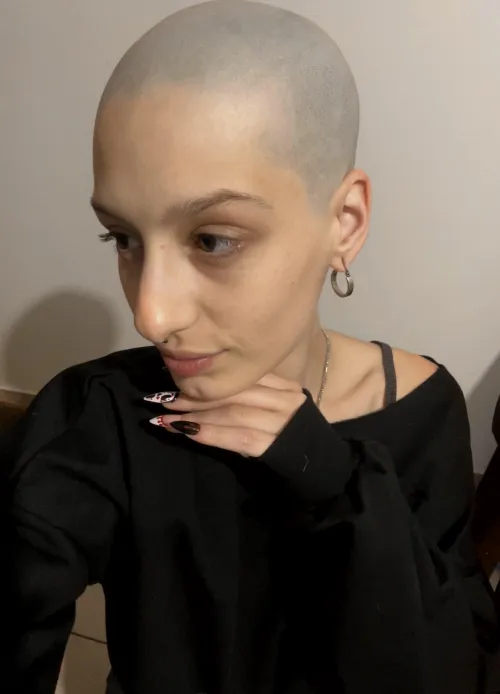 Thumbnail Bald Girls Fetish: Exploring the Allure and Beauty by sexypotionn