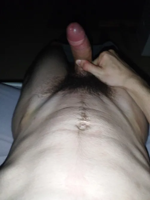 Thumbnail Mocked for My Hood: Foreskin Challenges Shared