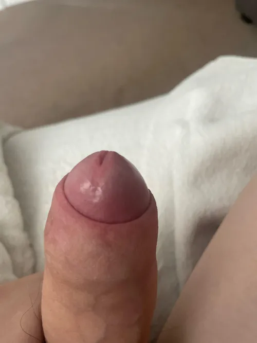 Thumbnail Exploring Foreskin - Insights from Pretty-Bison-9140