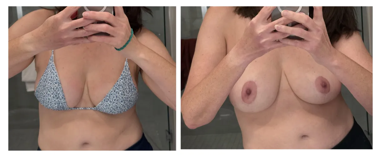 Thumbnail Before and After Transformation by MavnLane in DressedAndUndressed