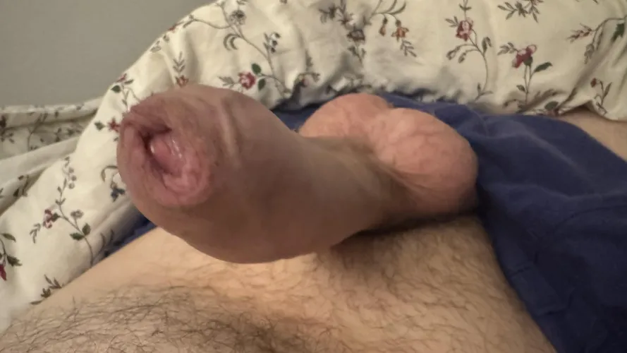 Thumbnail Sharing Secrets: More Foreskin Photos Await