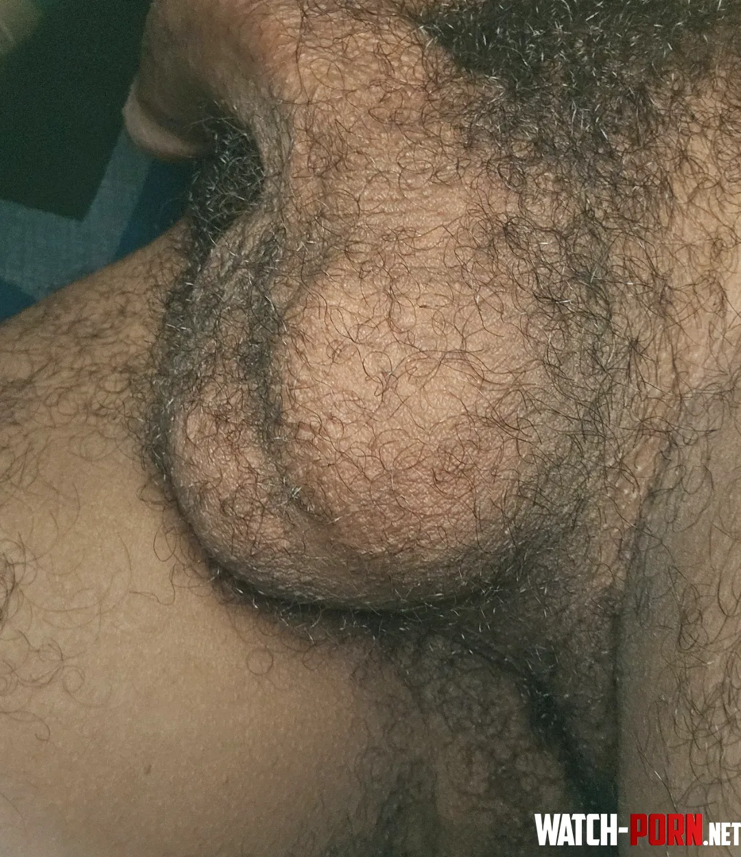 hairy balls19 by Key_Neighborhood4155