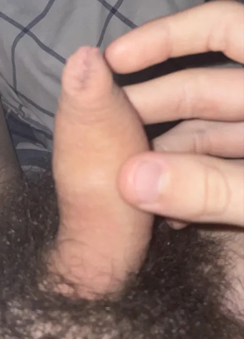 Thumbnail Analyzing Foreskin at 18: What Do You Think?