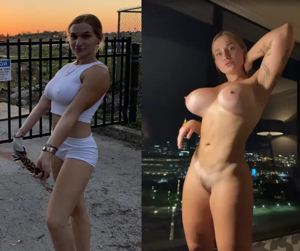 Thumbnail Zoie Burgher's Transformative Journey: Giant Fake Tits Unveiled