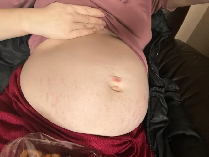 Thumbnail Who Wants to Feed Me and Help with My Stretch Marks? | Stuffers