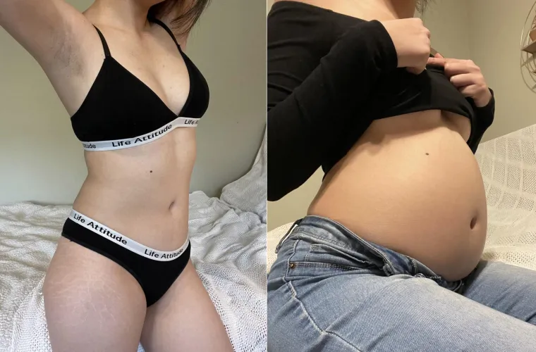 Thumbnail Asian Belly Girl's Transformation Journey | wgbeforeafter