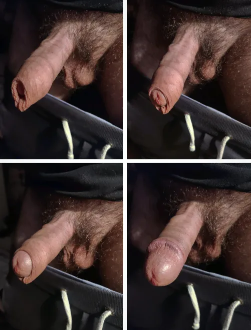 Thumbnail uncutavg's Foreskin Fancy: Time to Choose Favorites