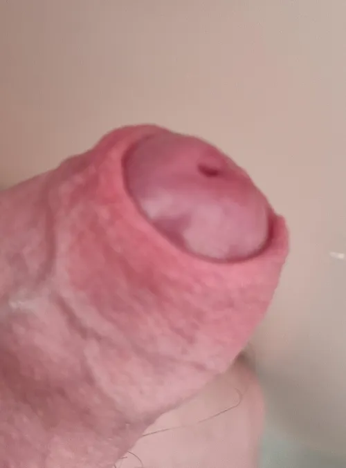 Thumbnail Journey with My Foreskin: A Personal Account by Gingerpubesuk