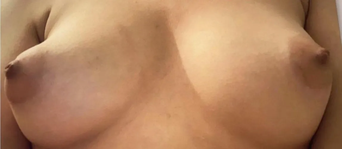 Thumbnail Rating My Boobs: sahar_04 Seeks Honesty in Sharing | ratemyboobs