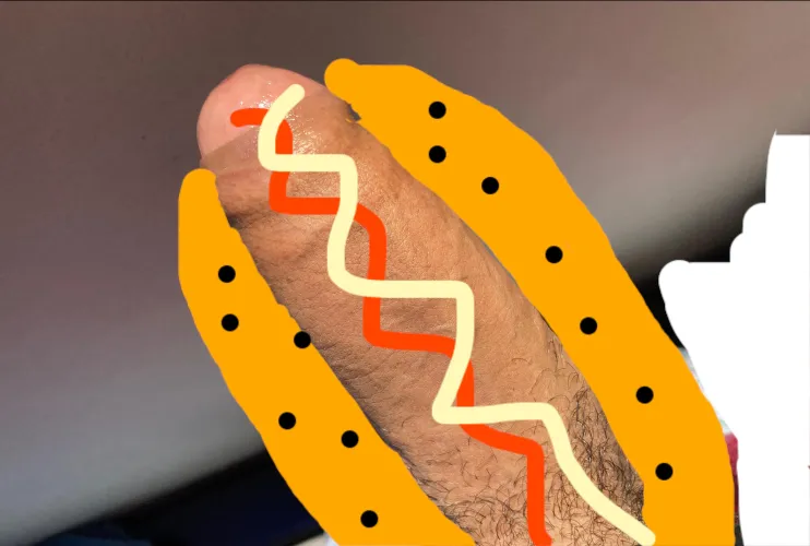 Thumbnail Hot Dog: Unraveling Foreskin Quirks with AggravatingWin224