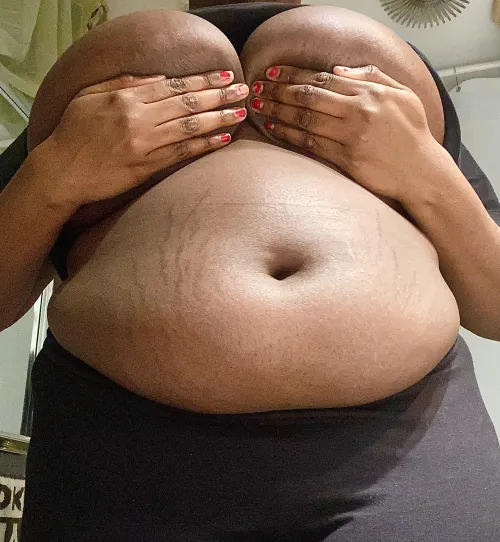 Thumbnail Embracing My Stretch Marks: A Story of Self-Love by chuncky_cutie