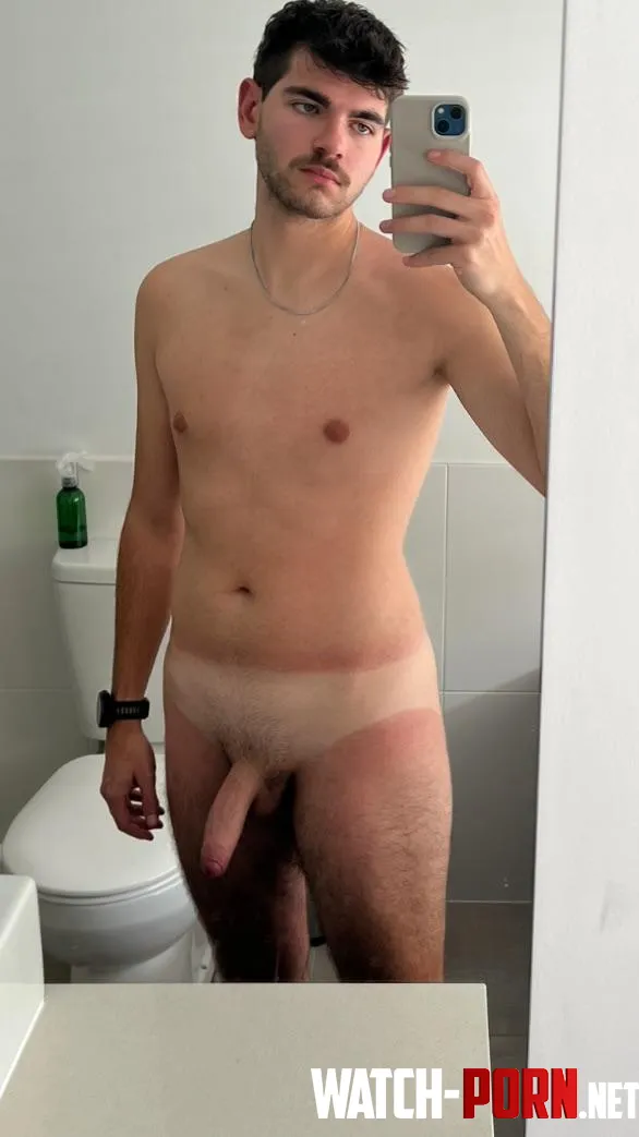 Treat my sunburn and Ill get it hard for you  by traveling-paul