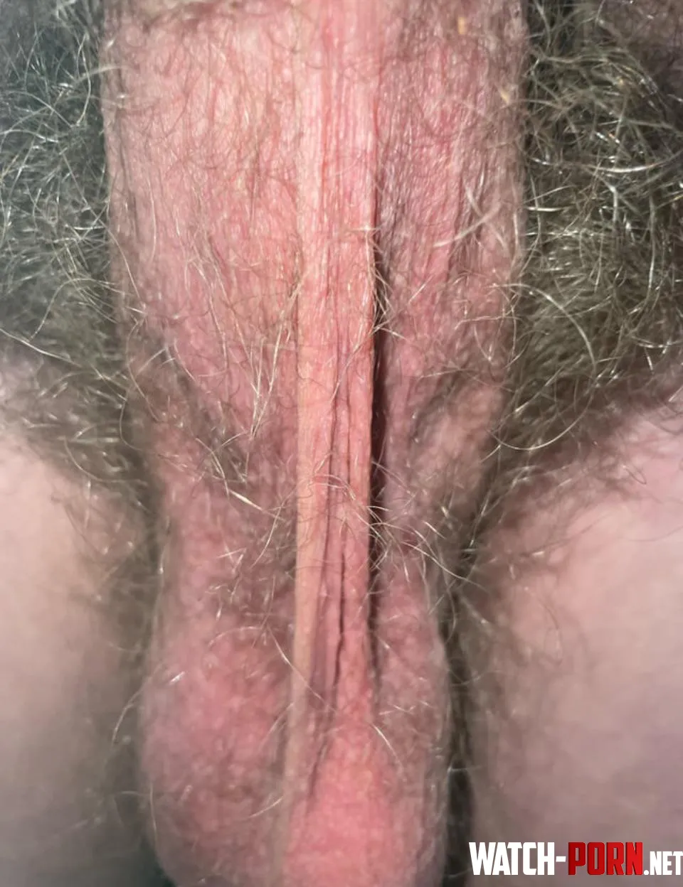 What do you think of these hairy young balls 18 by Scared-Revenue2841