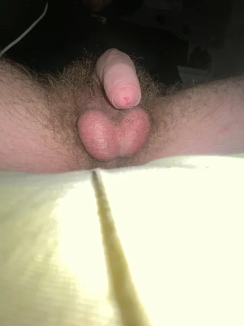 Thumbnail 21: Send Me Your Foreskin Pictures by Intensebugmuncher08