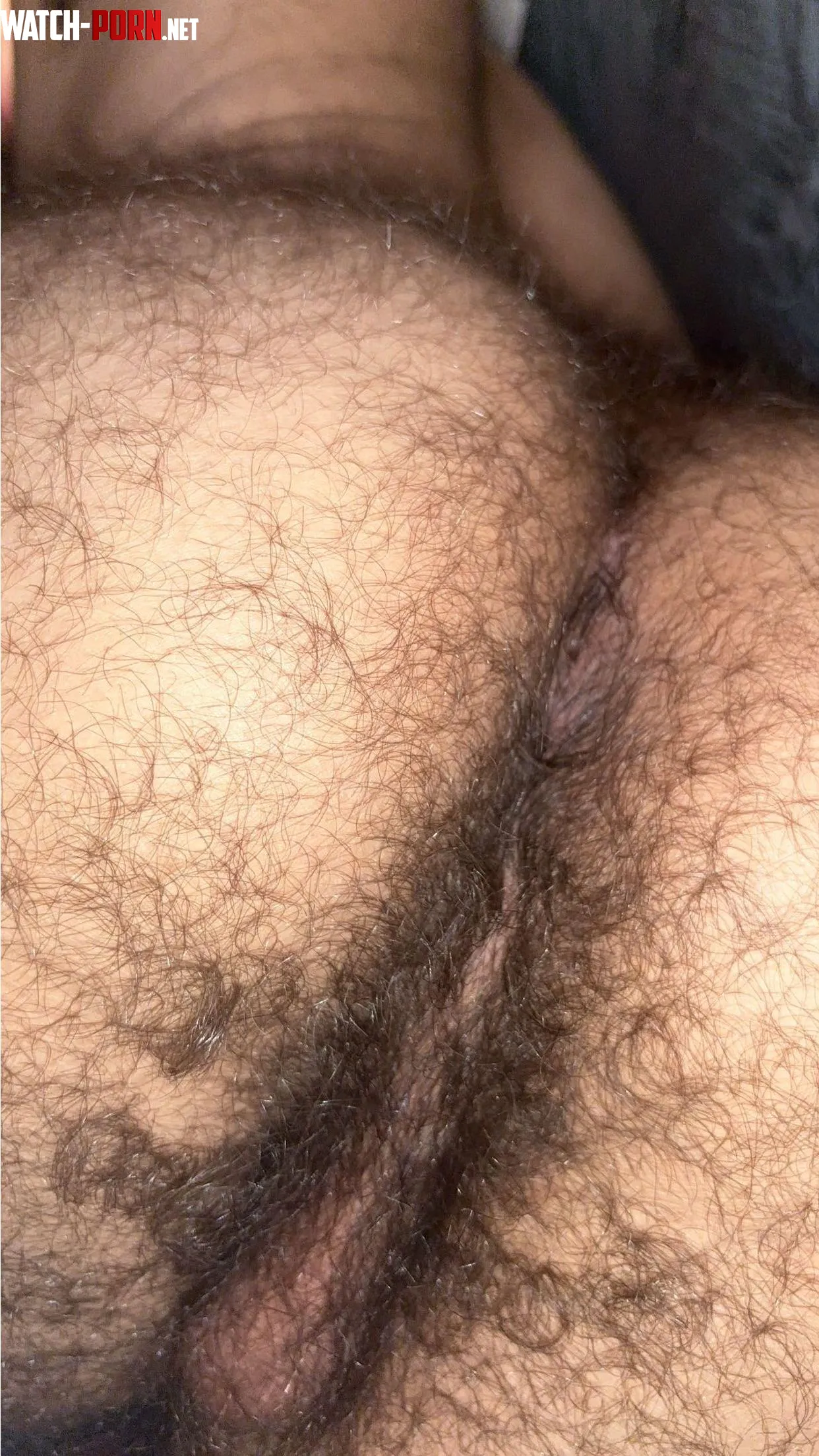 just my hairy manass  by Fancy_Arm7259