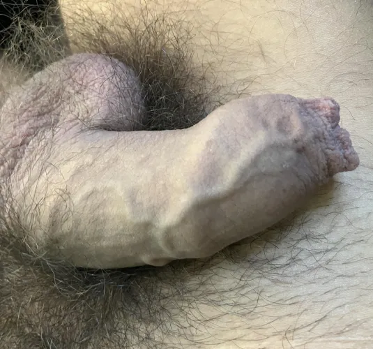 Thumbnail Foreskin Delight: Exploring the Joys of Docking - Hairy_Uncut_Dick