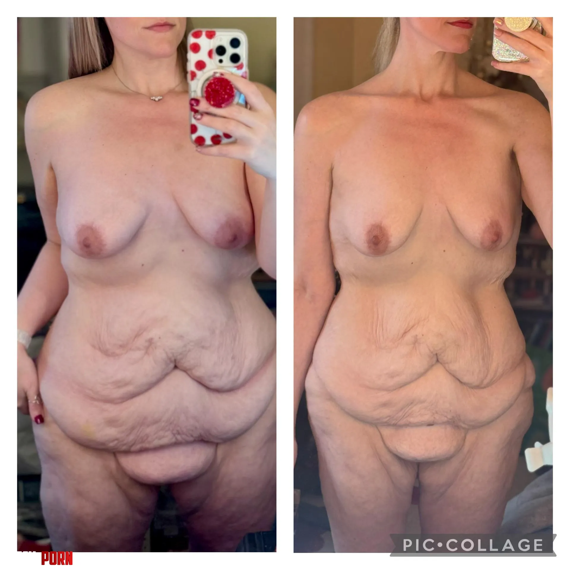 F40 58 153lbs massive weight loss and loose skin  by ilikecerealandsex