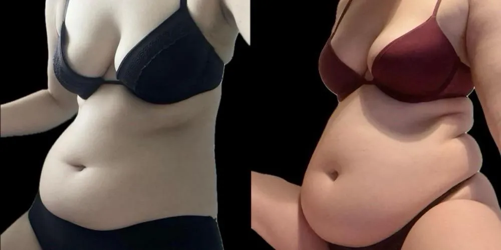 Thumbnail Witness the Transformation: Look what scarlett_belly Did - Bold Before & After