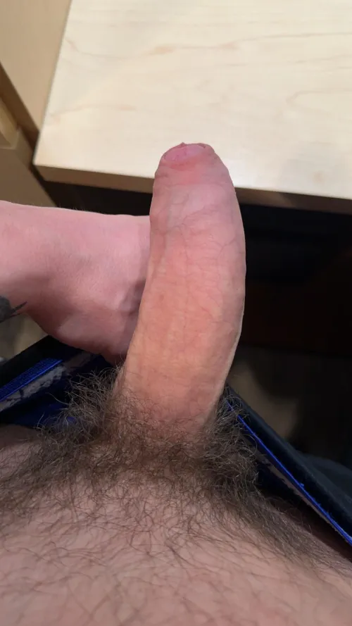 Thumbnail Exploring 'Skin Up' Topic with Odd-Impact7702 in Foreskin Category