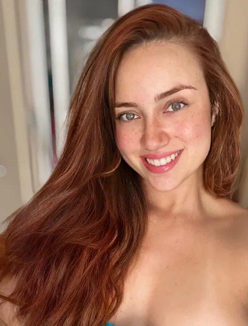 Thumbnail Redheads and Freckles: A Perfect Match Explored