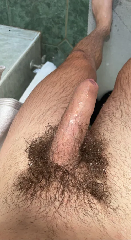 Thumbnail Anonboyredit Seeks Opinion on Foreskin Display