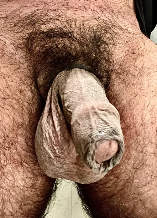 Thumbnail Professional_Rub7157 Seeks Your Thoughts on Foreskin – Share Your Opinions