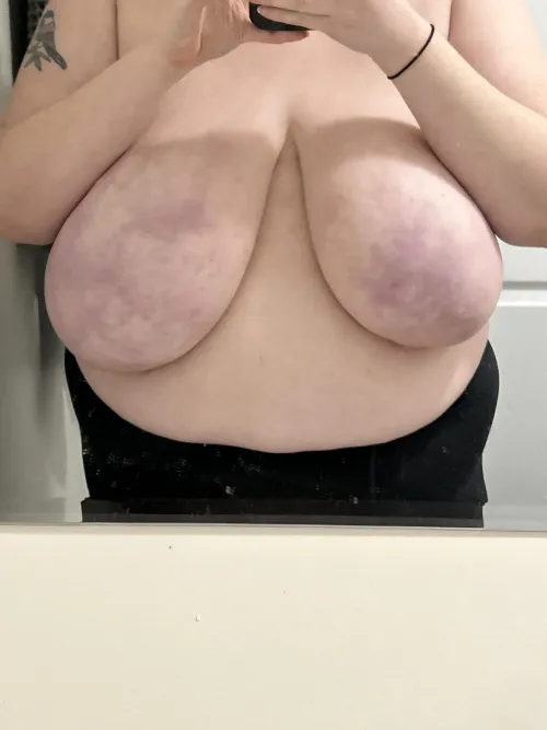 Thumbnail pretty38H's Revelation: Bruised Tits Secret in BBW Domain