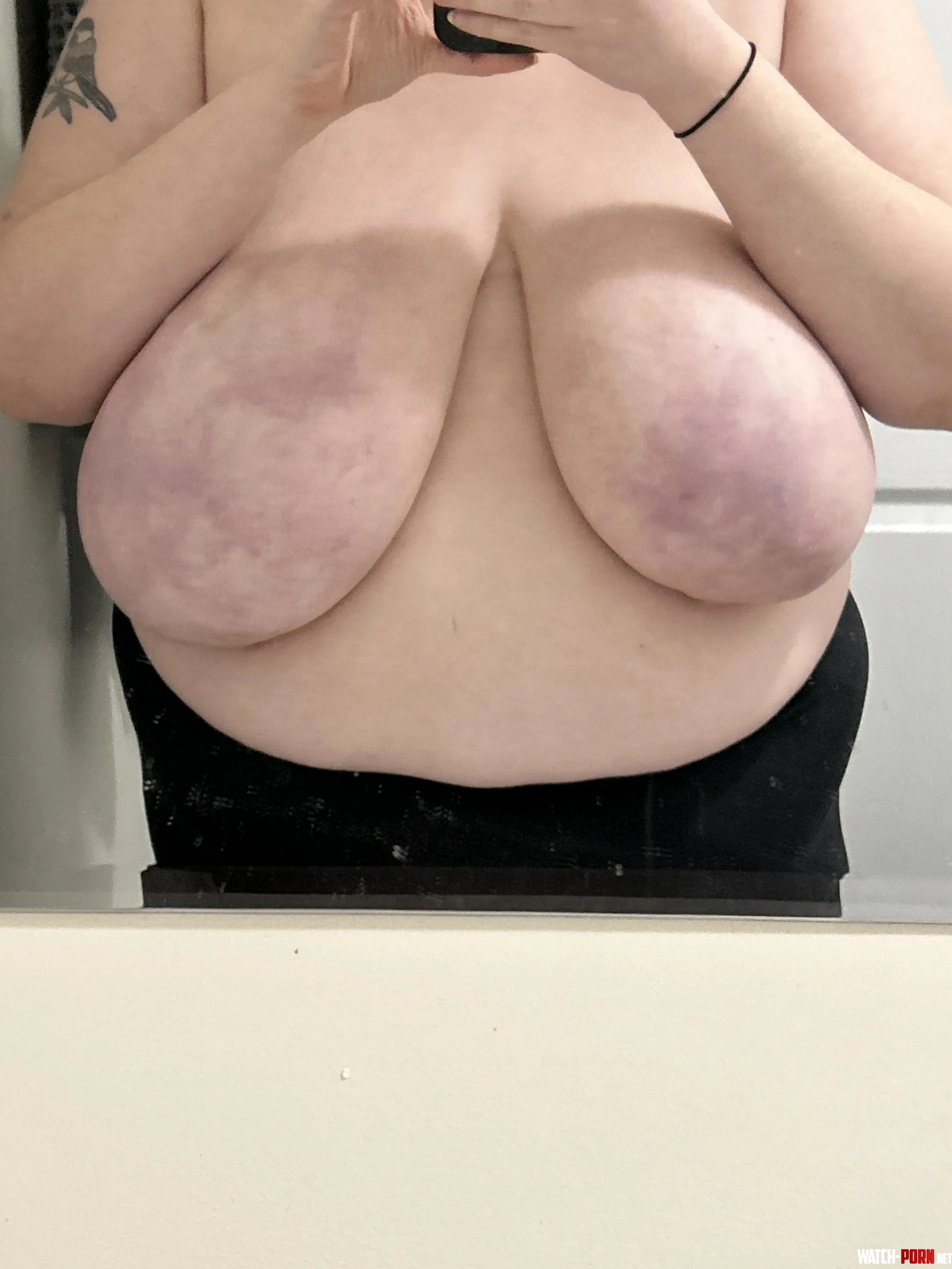 My tits look bruised when theyre cold by pretty38H