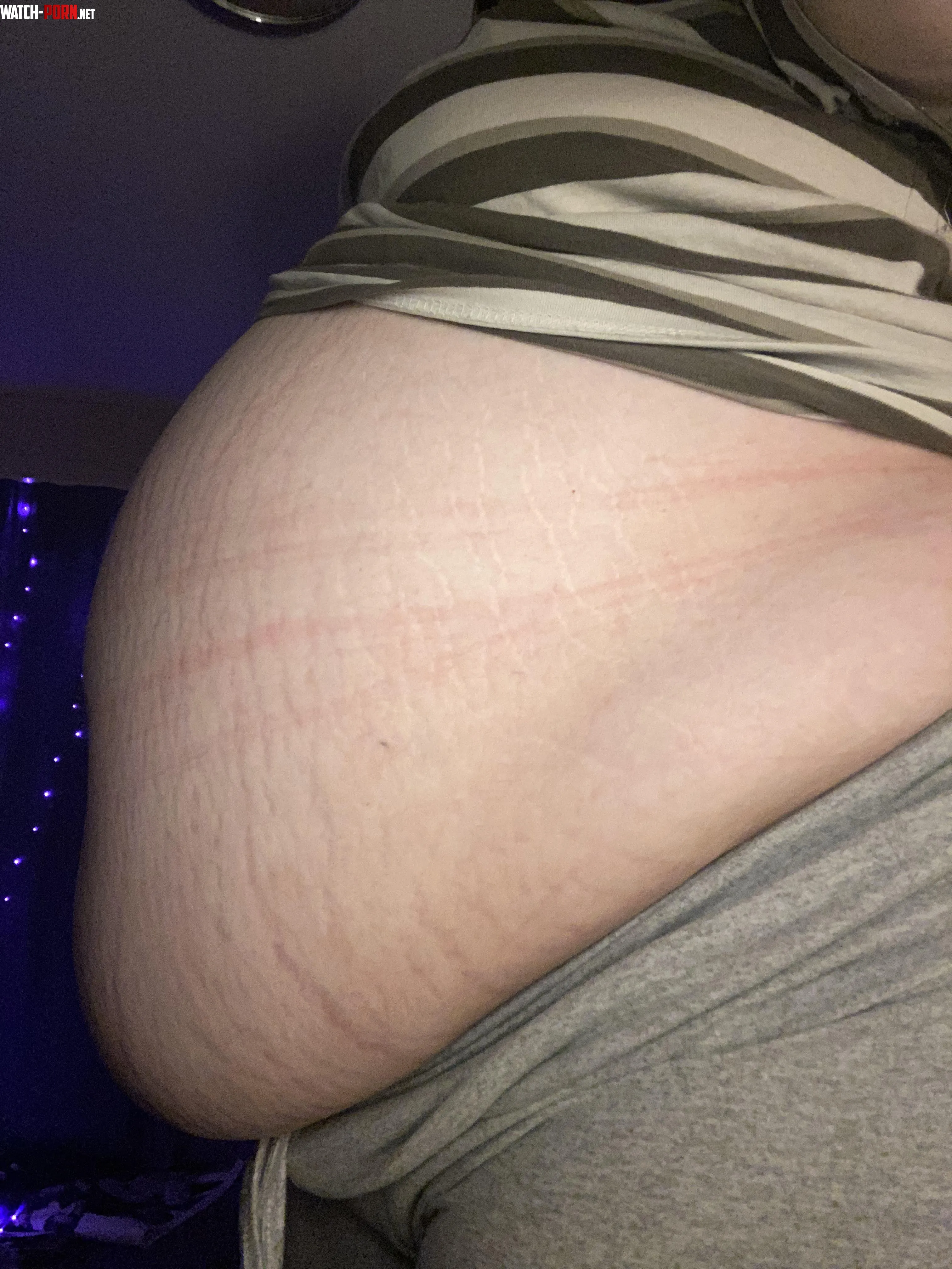 littered with stretch marks from growing so quickly i really am a piggy  by feedmeadelina