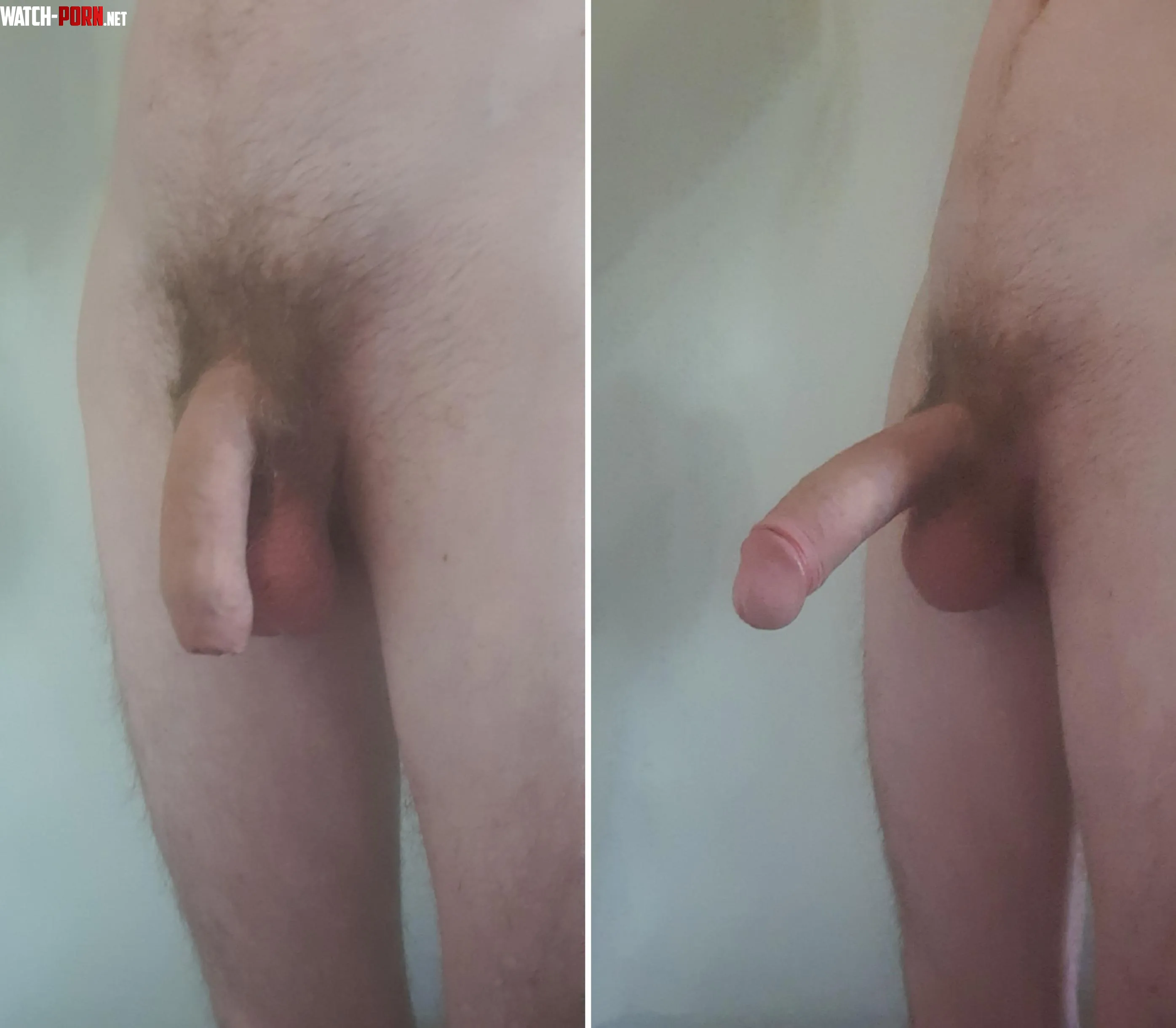 Anyone willing to help me buy a penis extender please by Sunyboy90